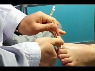 Chinese Foot Fetish (5) Foot Massage, Therapy and Toe Cleaning