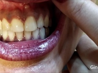 Mouth, uvula, tongue, teeth checks and endoscope