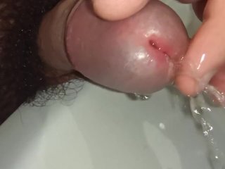 Playing with foreskin and pee. Cock close-up