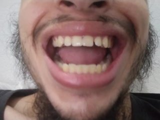 My teeth 