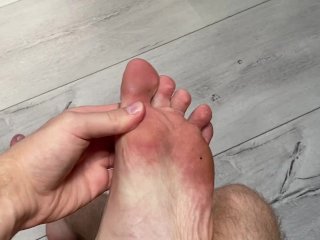 mikiesfeets dirty ugly and smelly