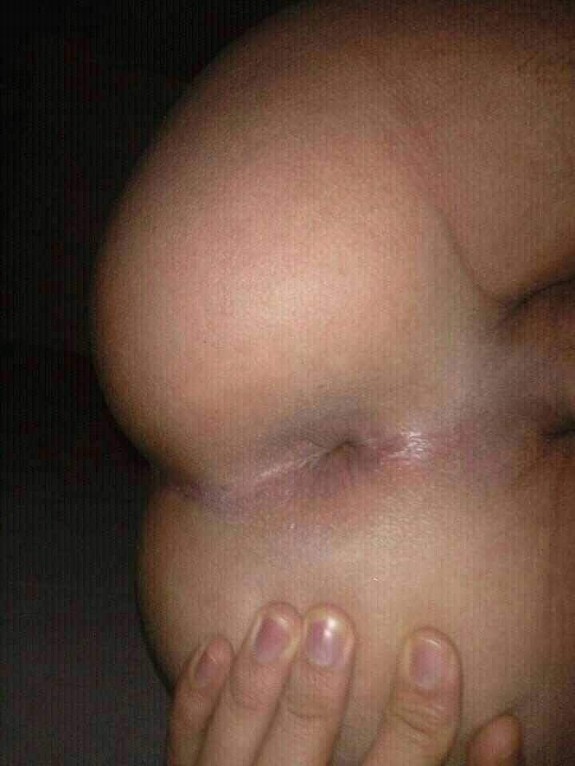 Gay ass anal asshole