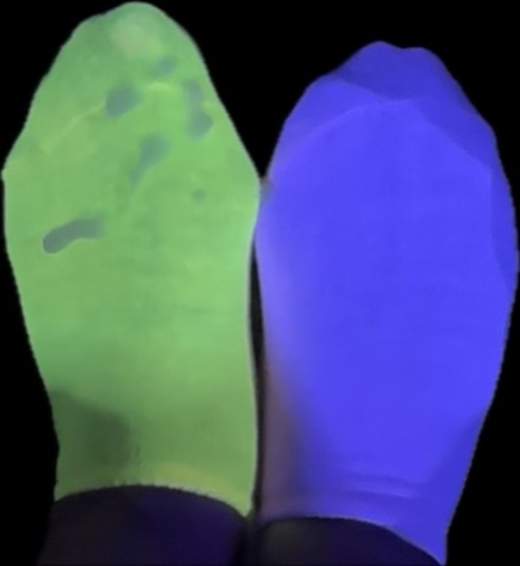 mismatched socks glowing in blacklight