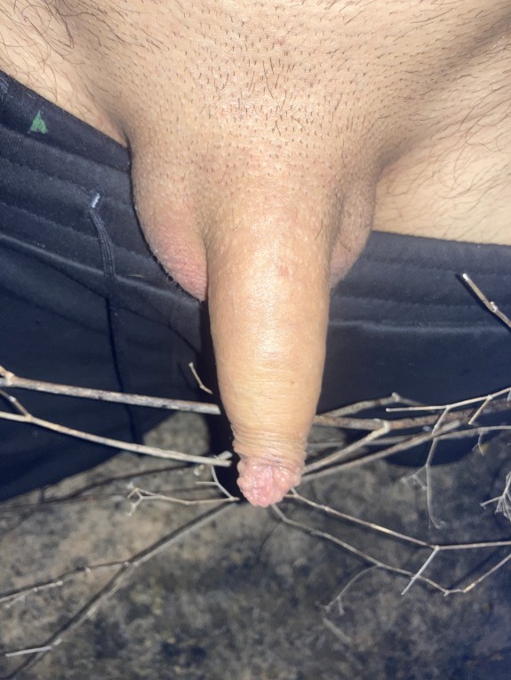 SWD (small white dick) photo