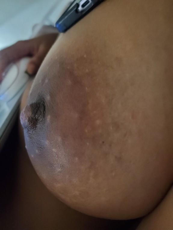 Fully naked body 