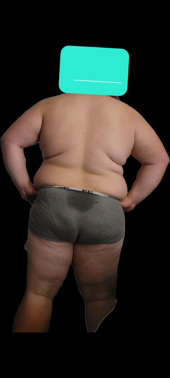 Weightloss start July 27 2024 @ 328lbs