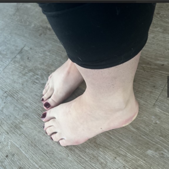 Outdoor fun