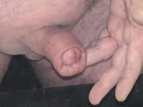 Penispump