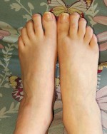 Unmanicured feet