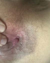 My hole photo