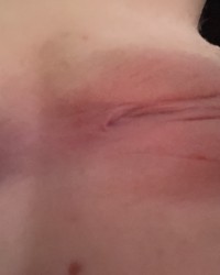 2024 nudes photo