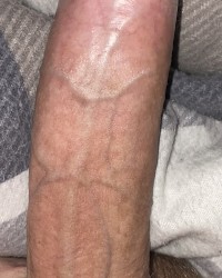 My Boner photo