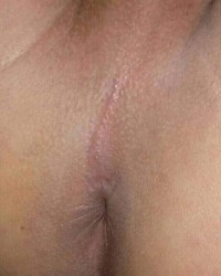 Gay ass anal asshole photo