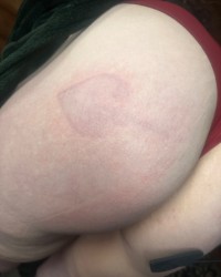 I got a spanking. Look at the spayed marks they felt so good photo