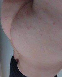Redheaded trans nudies photo