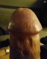 Horny circumcised cock 2 photo