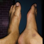 Thefeetandmore