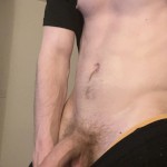 C0376