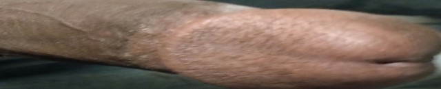 DickMeat