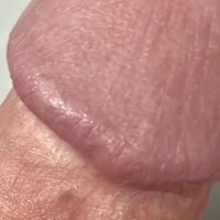 LkMcTuRniP