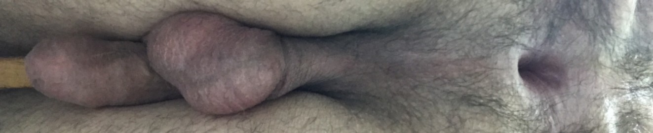 Mark93930