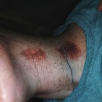 NBNSubslut