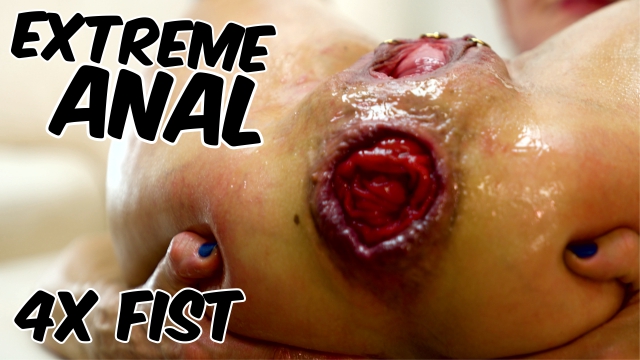 Double Fist Dominance Leaving No Space Unoccupied