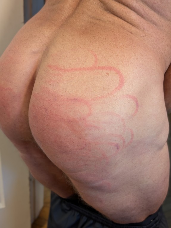 Ouch! Pain Slut, much?