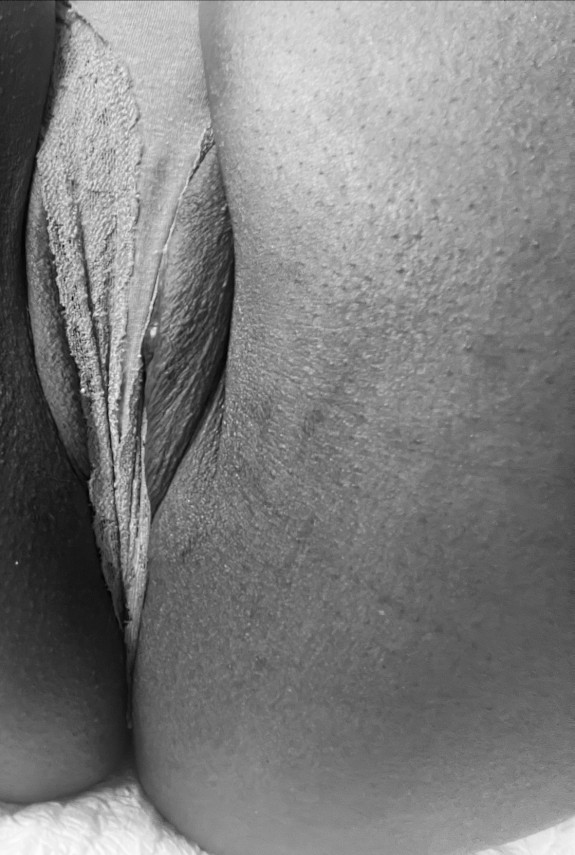 Kiss it better photo