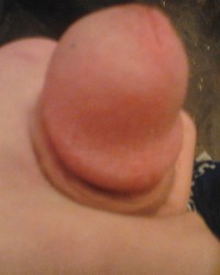 BIG DICK ALBANIA photo
