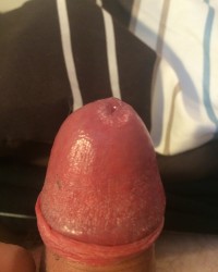 Dick Pics photo