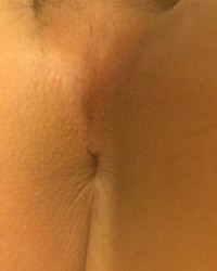 Meeeeee ya bakas photo