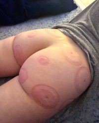 The Thickness photo