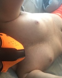 Pup scar photo