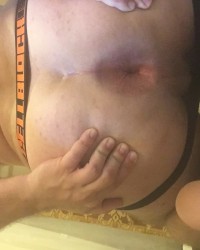 Pup scar photo