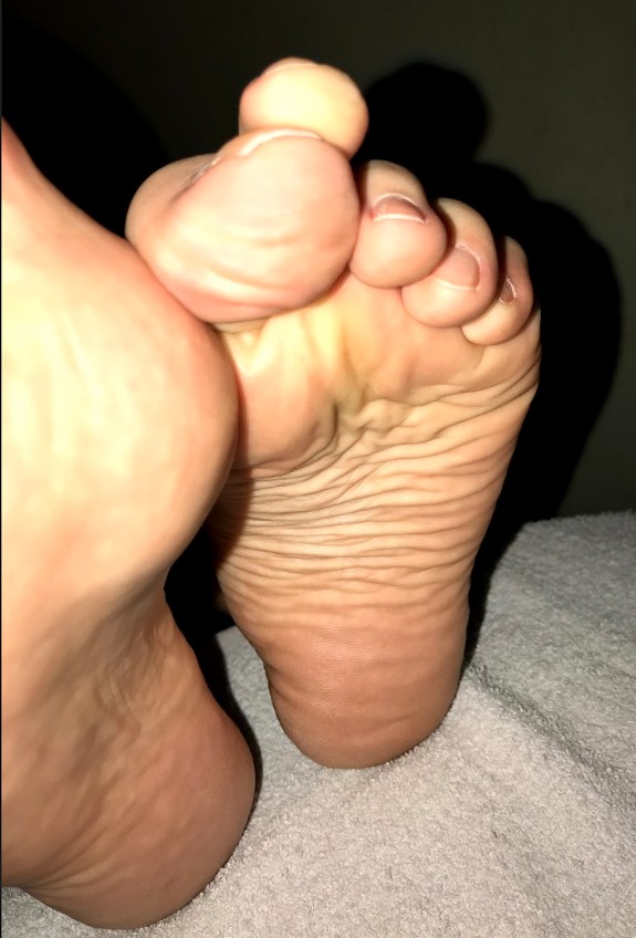 Wrinkled Soles & Feet - Pepper Bane