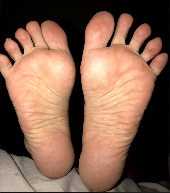 Wrinkled Soles & Feet - Pepper Bane