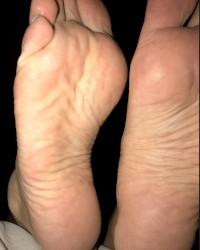 Wrinkled Soles & Feet - Pepper Bane photo