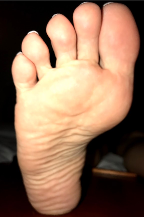 Wrinkled Feet & Soles - Pepper Bane
