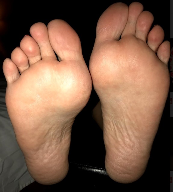 Wrinkled Feet & Soles - Pepper Bane