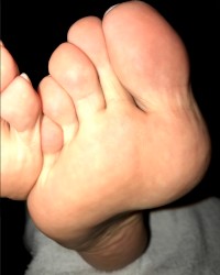 Wrinkled Feet & Soles - Pepper Bane photo