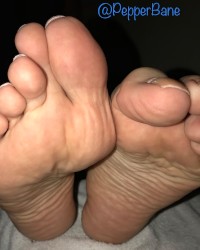 Wrinkled Feet & Soles - Pepper Bane photo