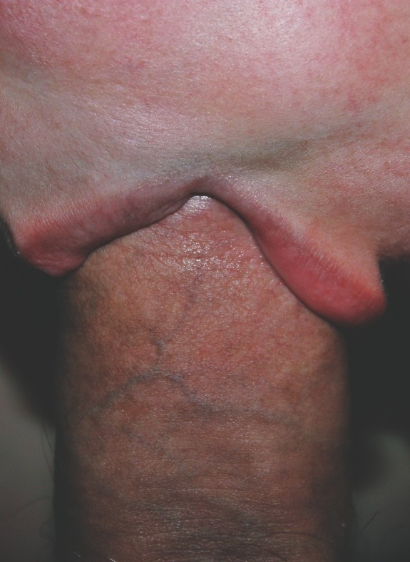 Miss Licky