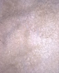 Semen Discharge photo