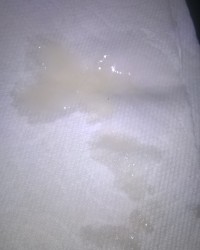 Semen Discharge photo