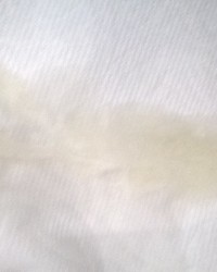 Semen Discharge photo