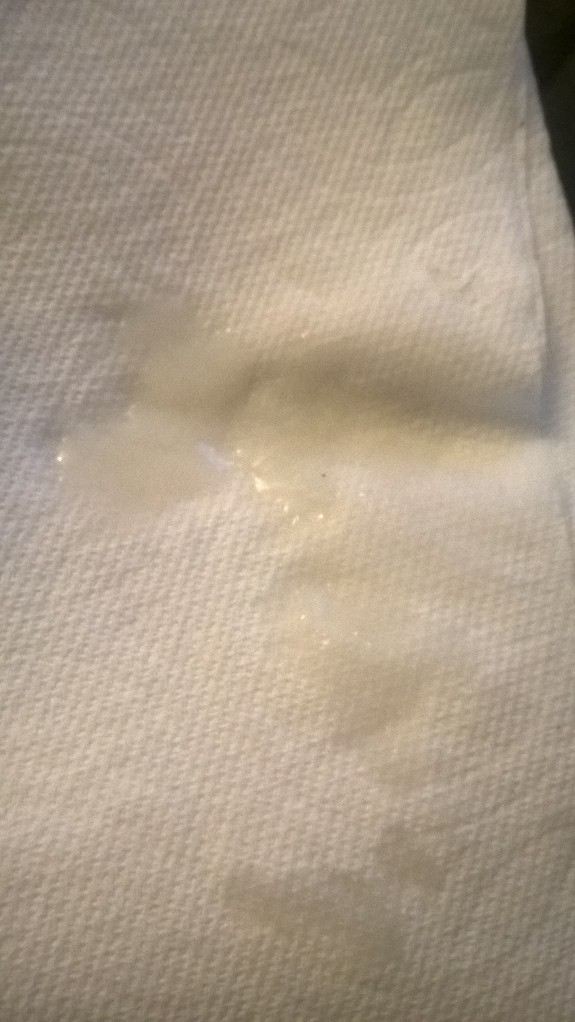 Semen Discharge