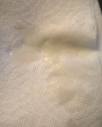 Semen Discharge photo