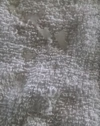 Semen Discharge photo