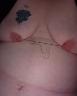 Sewn Stitched Up Tits on Fat Transgender FTM Bitch